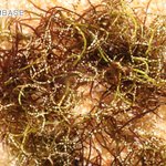 Chondracanthus acicularis